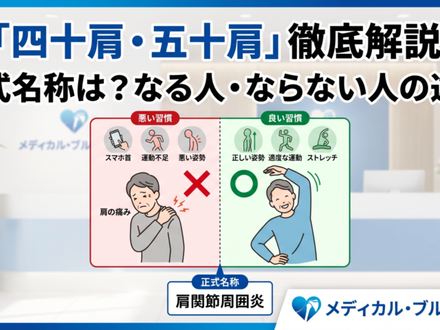 四十肩・五十肩の正式名称は？なる人・ならない人の違い｜メディカル・ブルー整骨院